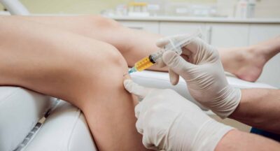 What is Platelet-Rich Plasma (PRP) Therapy?