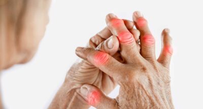 Why January Is the Right Time to Address Lingering Joint Issues